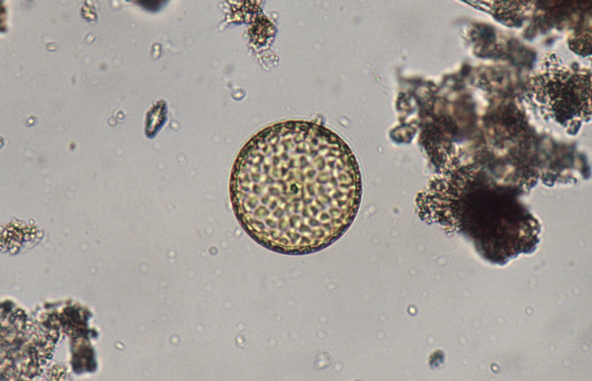 Diatomea di fitoplancton.