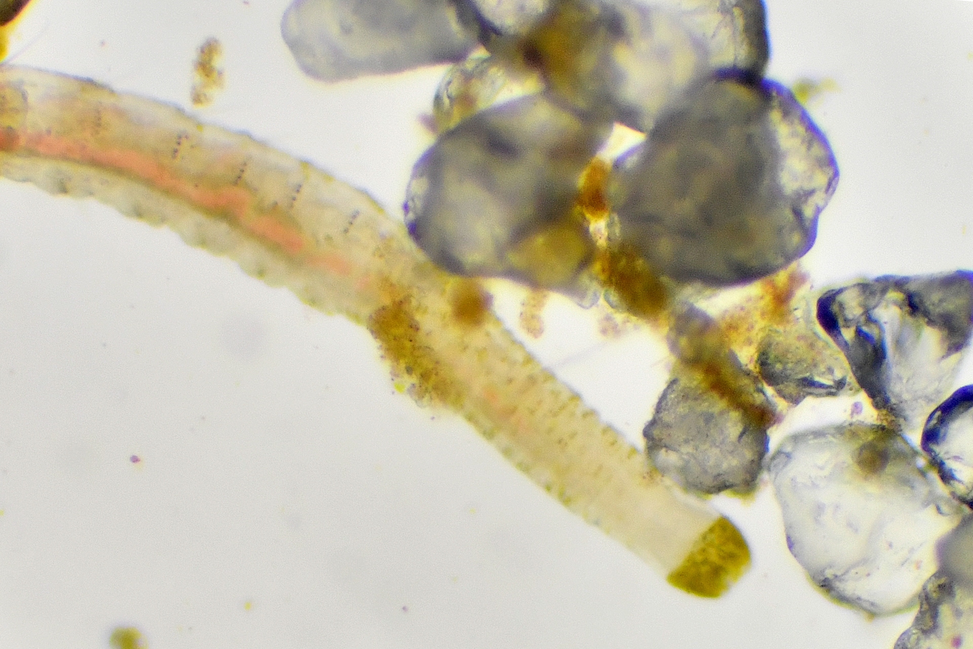 Una foto scattata al microscopio mostra un verme marino e granelli di sabbia.
