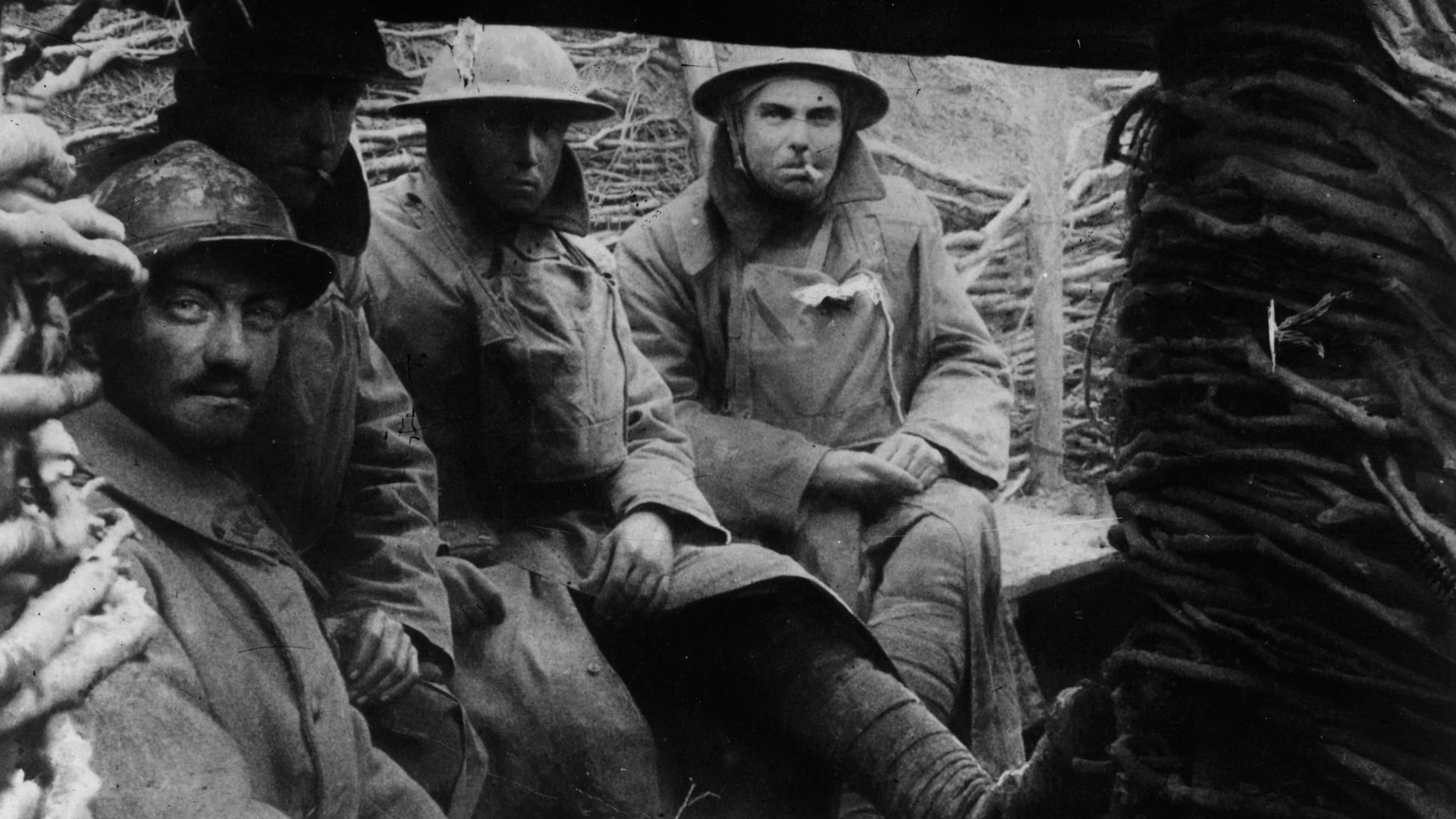 Окопная болезнь у солдата. Французский солдат в окопе. Фотографии 1 мировой войны. Британские солдаты в окопах. Первая мировая война хроника.